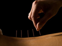 Oscar-winning Director Takes a Fancy to Chinese Acupuncture