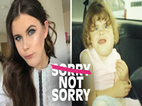 The Beauty Blogger with a Facial Disfigurement