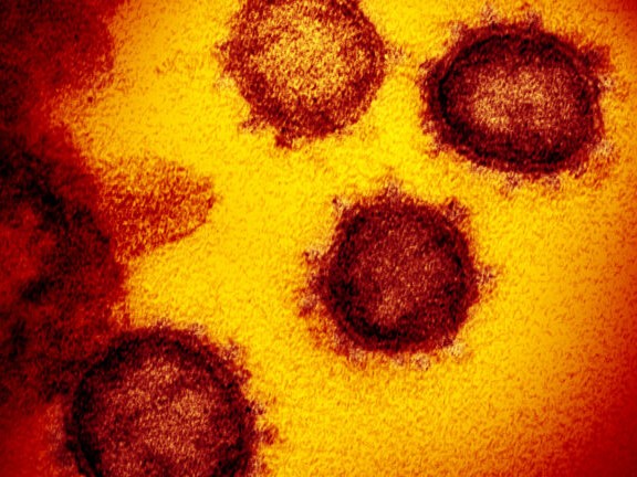 Here's Where Coronavirus Hides in Your Body