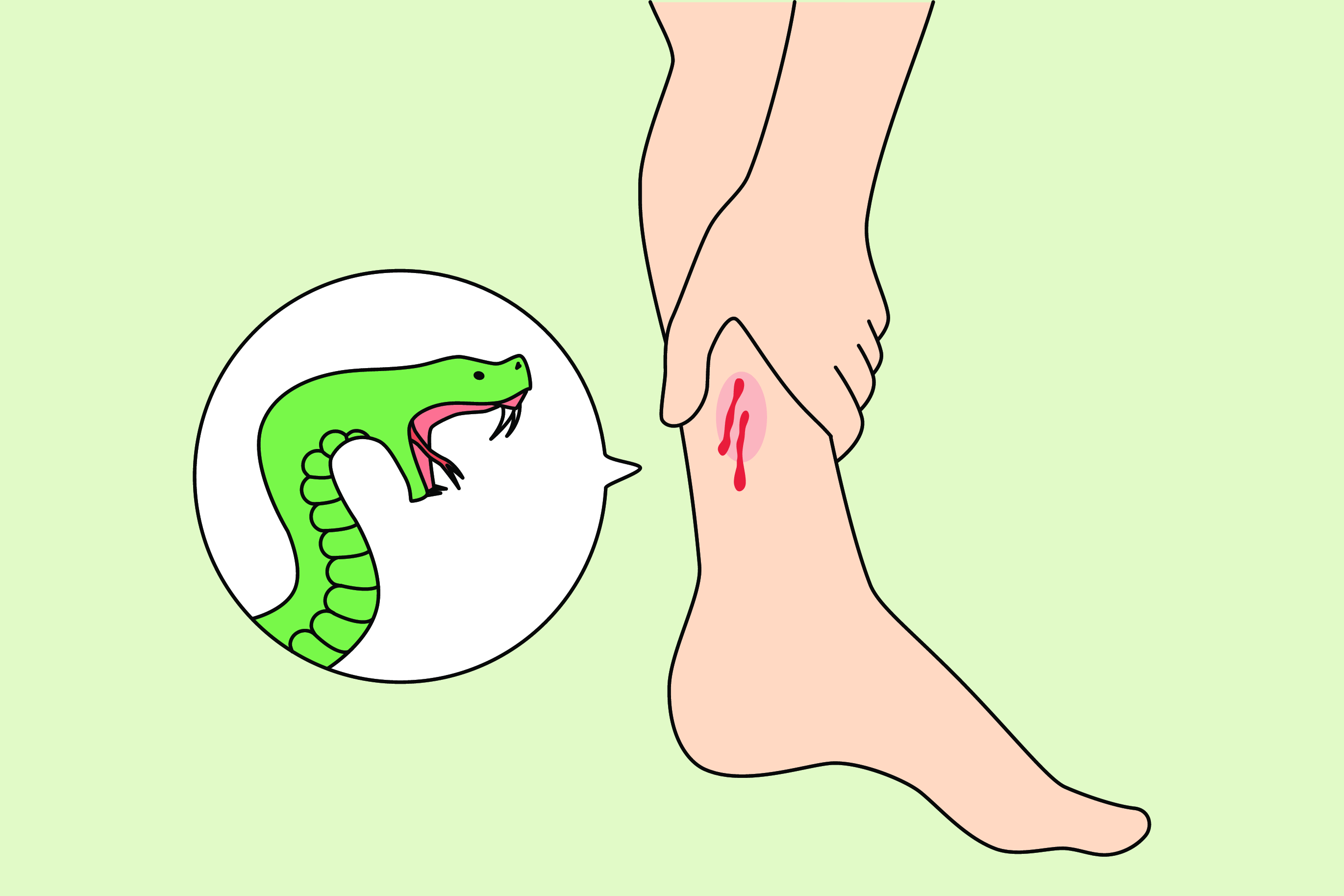 新闻听力 | 蛇咬生存秘籍